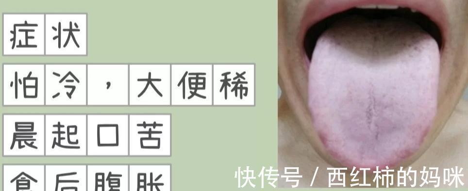 大便|便秘、大便先干后稀、大便溏稀不成型、羊屎便都是怎么回事?