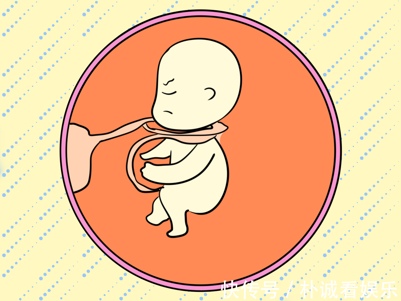 剖腹产|脐带绕颈的发生率为20孕妈先别慌,处置妥当胎儿会自行脱困!