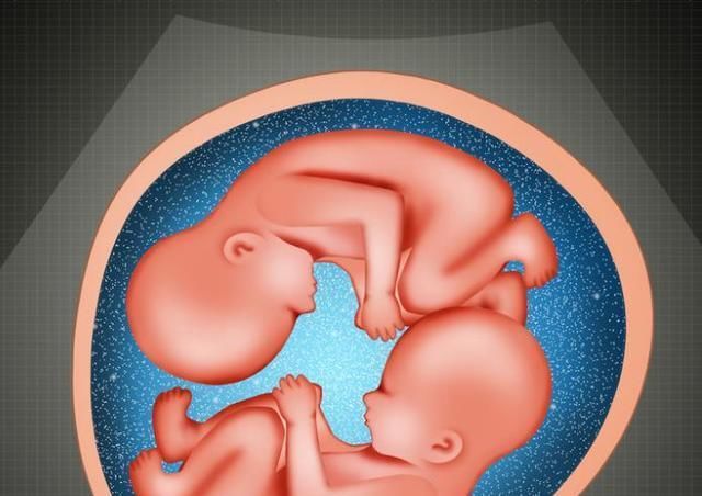 胎盘功能|胎儿大小与实际孕周不符？不仅仅是“算”错了，还有这9个原因！