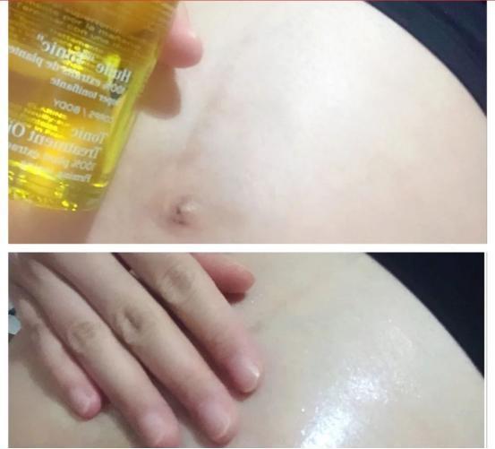 这些事|怀了两胎都没长妊娠纹?孕期三阶段做好这些事,花肚皮远离你