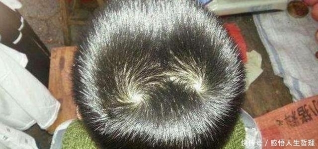 头旋|孩子头上的“旋”的个数,暗示孩子智商高低家长要了解真相