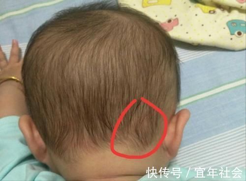 孩子|“两个旋”的孩子更聪明?关于“头旋”个数,有两件事情要知道