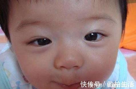 一日三餐|5岁男童脾胃功能“衰退”，医生：3种习惯，是娃积食的“元凶”