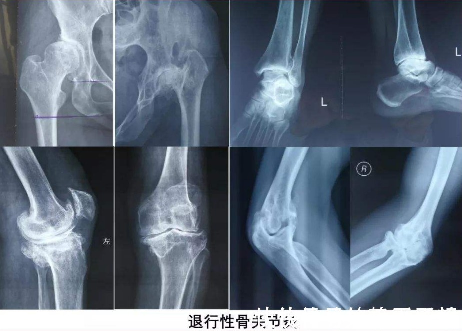 膝关节炎|民间土偏方:“豆浆+南瓜”一起煮,一周喝3次,膝盖不疼了