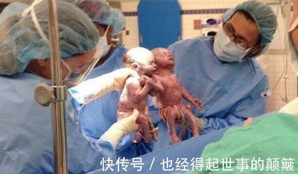 形影不离|双胞胎姐妹花手牵手一起出生,如今2岁了,两个人依旧是形影不离