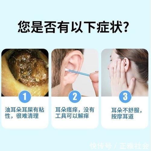 小冰|生下来从不掏耳朵的孩子:6年的耳屎变成“水泥柱子”,多久清理一次合适?