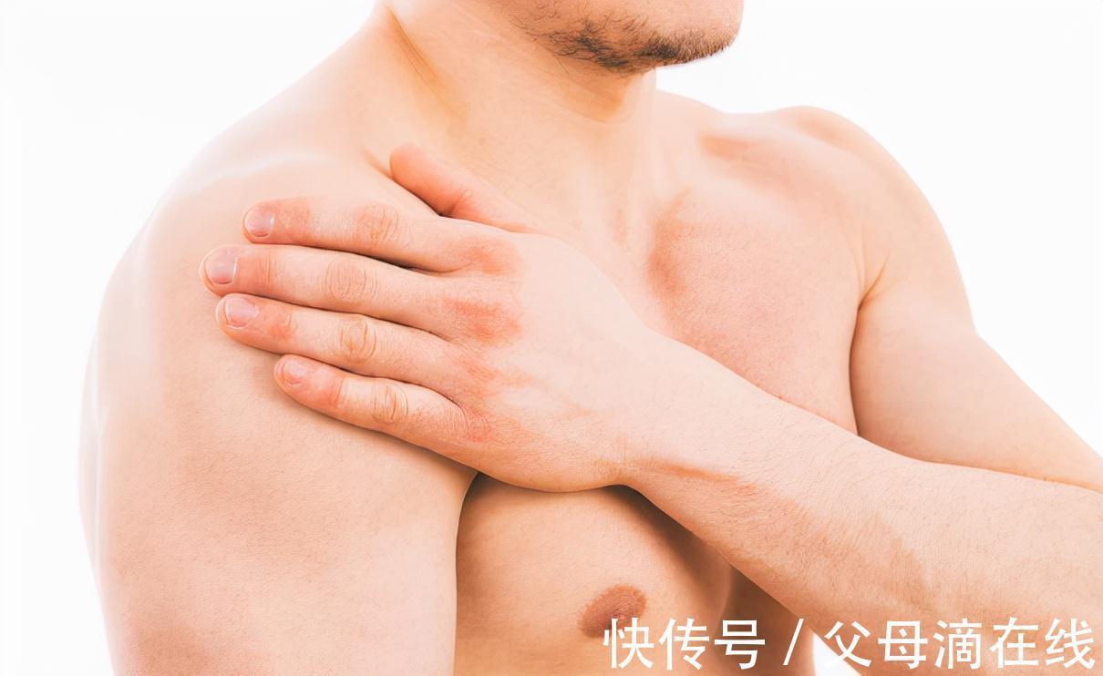 关节|肩膀疼痛是肩周炎吗?缓解“疼痛”日常坚持3个习惯
