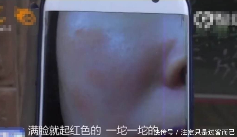 美容师|女子充1万做美容,脸越做越丑退款2年未果,店家:再等几天