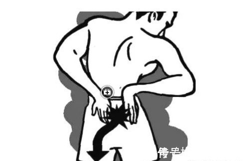 坐骨神经痛|十多年的腰间盘突出，花了好几万，最后1个赤脚中医小方，治好了