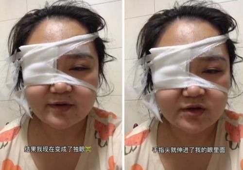 独眼|剖腹七层生下你,你却让我变“独眼”,宝妈:别让孩子伤害了你