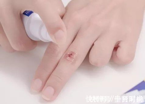 手指|三岁女童被活活截断手指,终生残疾!只因用错创可贴,快自查
