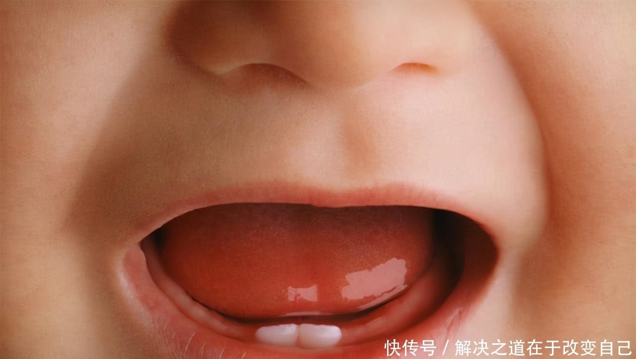 牙床|宝宝半夜发热,宝妈火急火燎送医院,医生扒开嘴一看:可以回家了