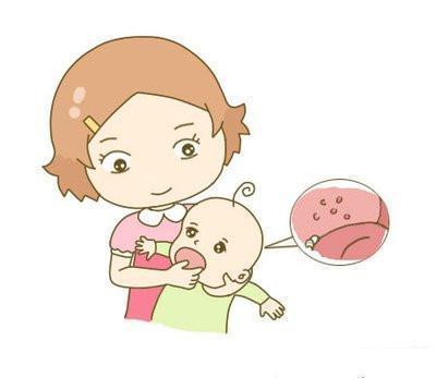 灼烧感|宝宝口腔溃疡了怎么办预防远比治疗更重要,父母学起来