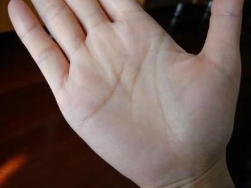 苹果|苹果能否降血脂?医生提醒:做好这“3件事”,或能有效降血脂