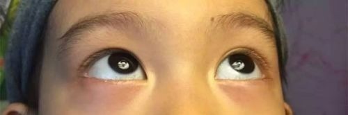 脾虚|男孩1年长17厘米,医生:有这个好习惯,长个不发愁