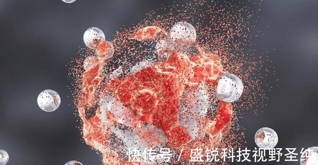 癌症|血常规能查出癌症吗?医生:“揪出”早期癌症,不要放过这3项