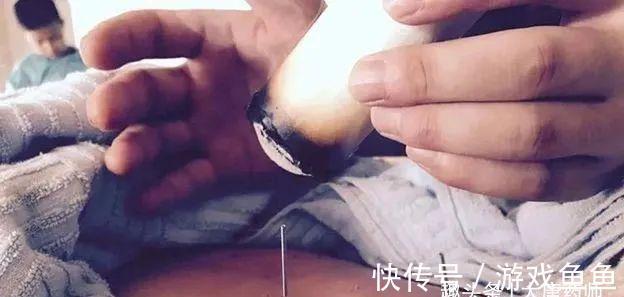 浊气|三伏化淤黄金期!灸4穴,调和气血,打通全身瘀血,预防各种结节