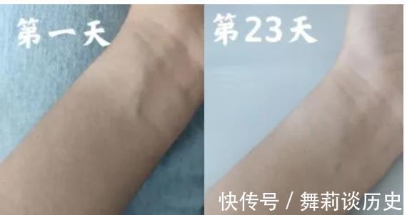 斑块|每天喝”柠檬水“会变白?86岁老院士提供美白“方子”:是这3物