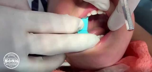 玩具|1岁女童玩玩具,贴在嘴里2个星期取下来时全是血