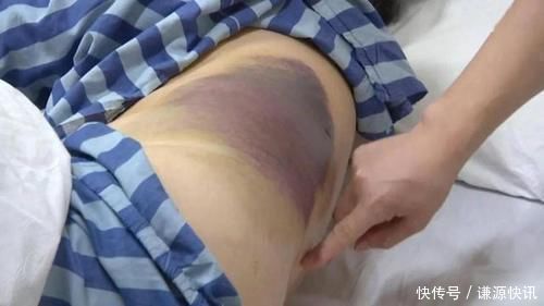 锻炼|老年人锻炼“黑名单”来了这10种方式，不能强身，反而伤身