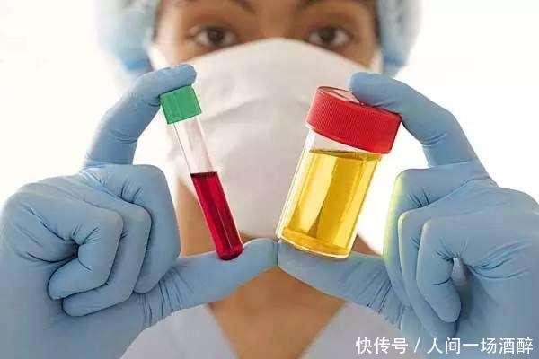 尿酸偏高的人,尽量少碰这3类高嘌呤食物,痛风或会绕着走