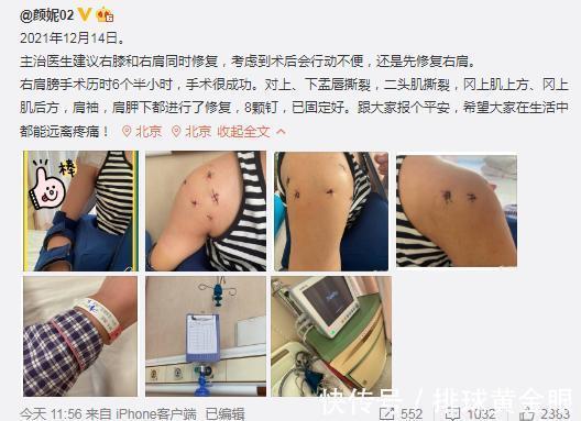 右肩|颜妮右肩植入8枚钢钉，还将进行右膝修复，朱婷手术时间牵动人心