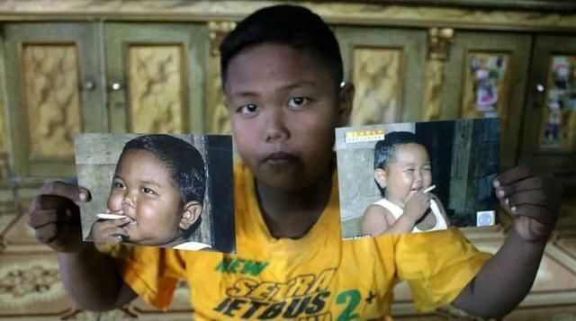 克烈|2岁染上烟瘾的孩子,一天抽40根烟,如今10岁的他变成什么样了