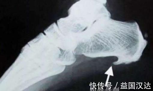 韭菜|8个冷门妙招,家家不可或缺!上可治五脏,下可治四肢!