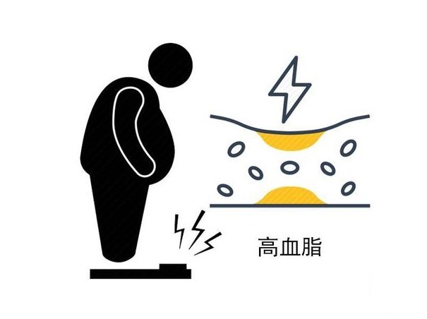 血液粘稠度|得了高血脂,如何预防心脑血管疾病?这几个方法,或能帮您避免