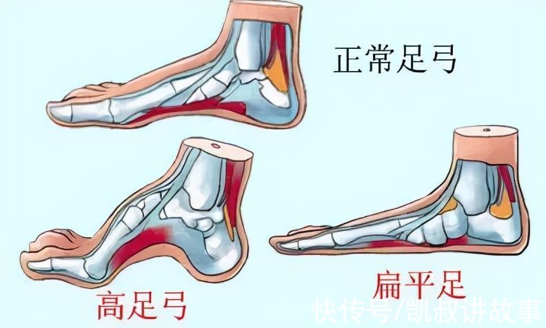 鞋子|最新童鞋黑名单：最伤孩子的4种鞋，千万别再穿了，尤其第一种