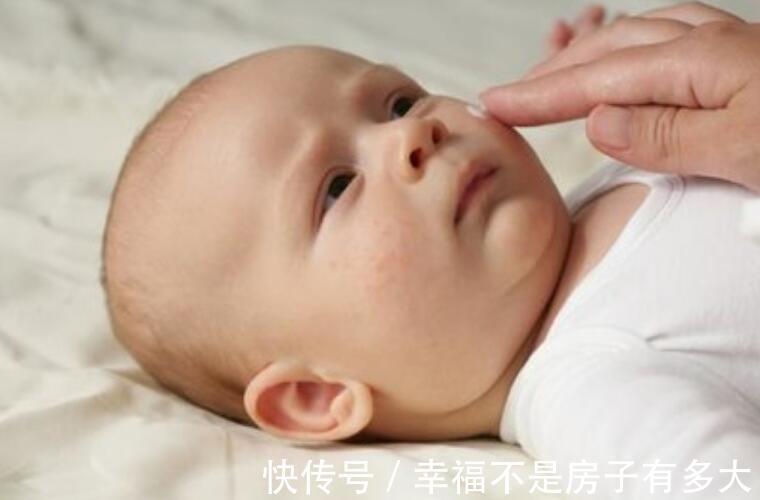 妈妈|母乳妈妈不忌口,宝宝得了湿疹2类食物别再吃了