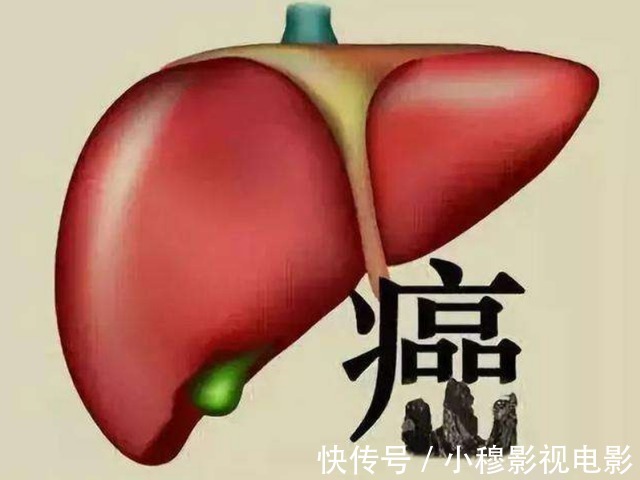 肝炎|肝癌“源头”已找到，医生提醒：停止食用“1调料”，趁早扔掉