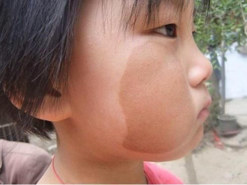 不想让宝宝有胎记？孕妈3种行为有关系，怀孕后不要太任性