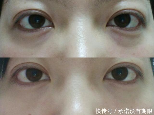 护肤|还在跟着美妆博主学护肤的小姐姐们,你们的脸还好吗