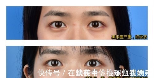 治疗 十大一定“不踩雷”的医美项目，一篇带你秒懂抗衰届yyds