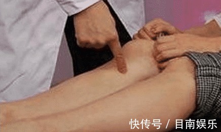 乙肝|太多明星死于肝癌,肝癌发生前身体会出现预兆,仔细观察