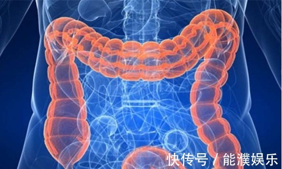 肠道|肠癌的“元凶”已被找到,医生忠告做好这4点,肠道才会更好