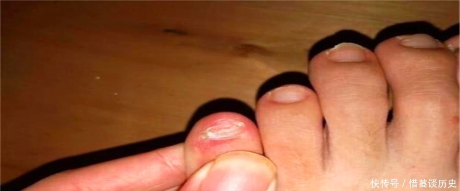 河北|小脚趾的指甲分成两半的人，他们究竟什么来历？说出来你别不信