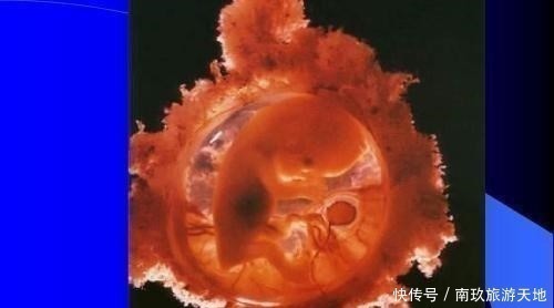 怀孕|胎停并非“毫无征兆”，孕妇出现这5个表现，可能是胎儿不发育了