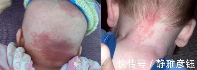 理论|发现新生儿小屁屁上有“淤青”，老公想找护士理论，最后暗暗庆幸