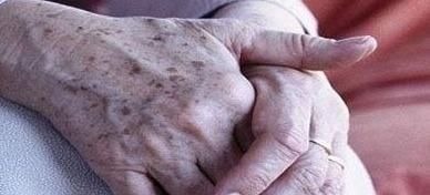 我们来了|为何年纪大了容易有老年斑,营养专家常吃两物,可能及时避免