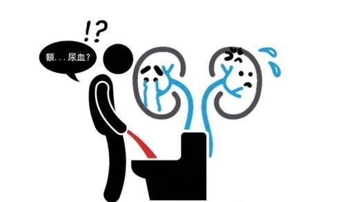 高钙血症|实不相瞒!这种症状若出现,或是肾癌已到来,千万别再拖!