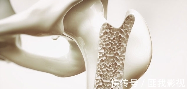 骨质疏松|3种肉类是天然“强骨剂”,医生提醒:骨骼不好的人,别不舍得吃