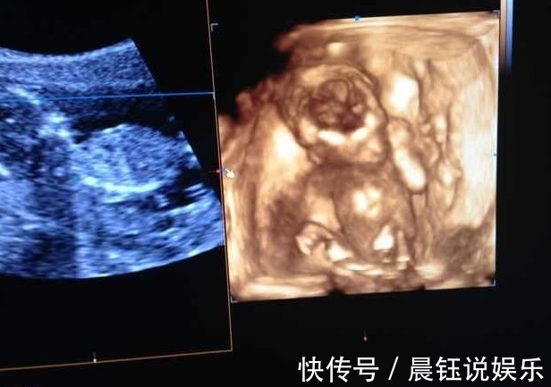 产检|婆婆陪孕妇去产检,医生将婆婆支开,问了一个问题,孕妈瞬间脸红