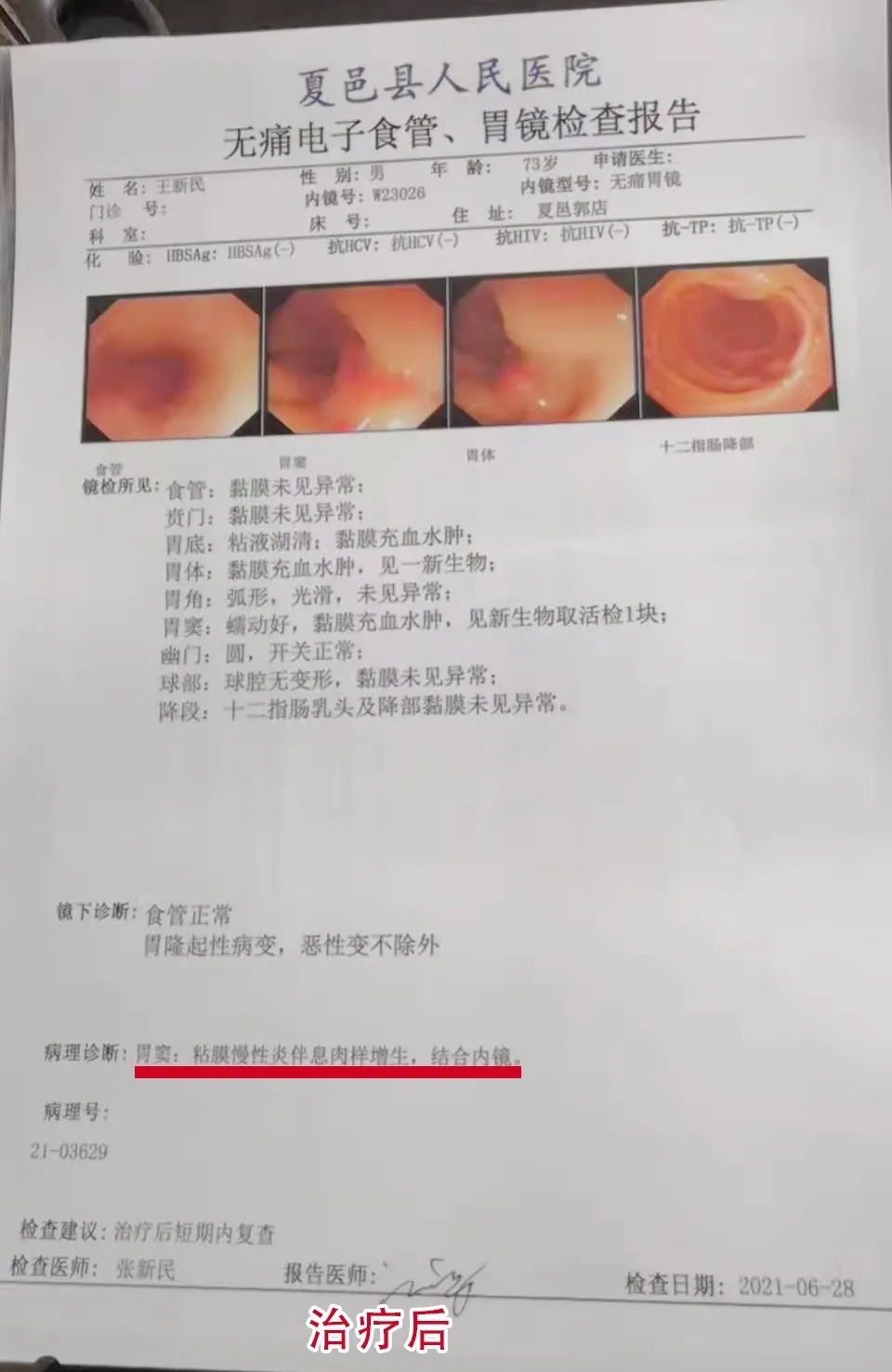 目的|中醫治療胃癌肝轉移，治愈就是目的！