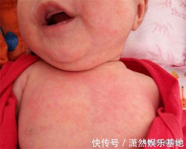 鸡蛋羹|为啥最好别给孩子吃鸡蛋羹?儿科医生劝诫数次,父母仍乱来