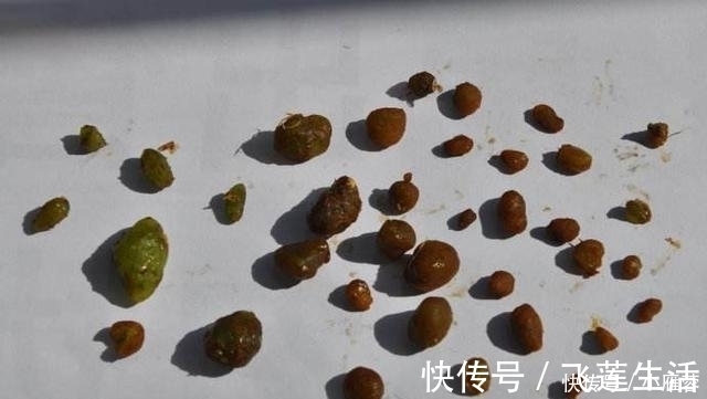 睡眠质量|肝毒重的人, 夜里会有这3种情况, 可别忽视了