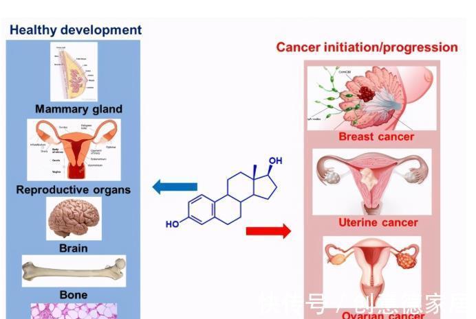 雌激素|都说50岁是女人的一道坎，年龄一到下肢无力全身疼痛就来了，咋办