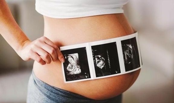 有早|孕妈妈显怀时间有早有晚，不用太过纠结，其实和这些因素有关！