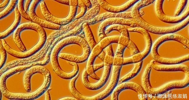 孩子|孩子出现这5种症状,要注意宝宝肚里可能长蛔虫啦